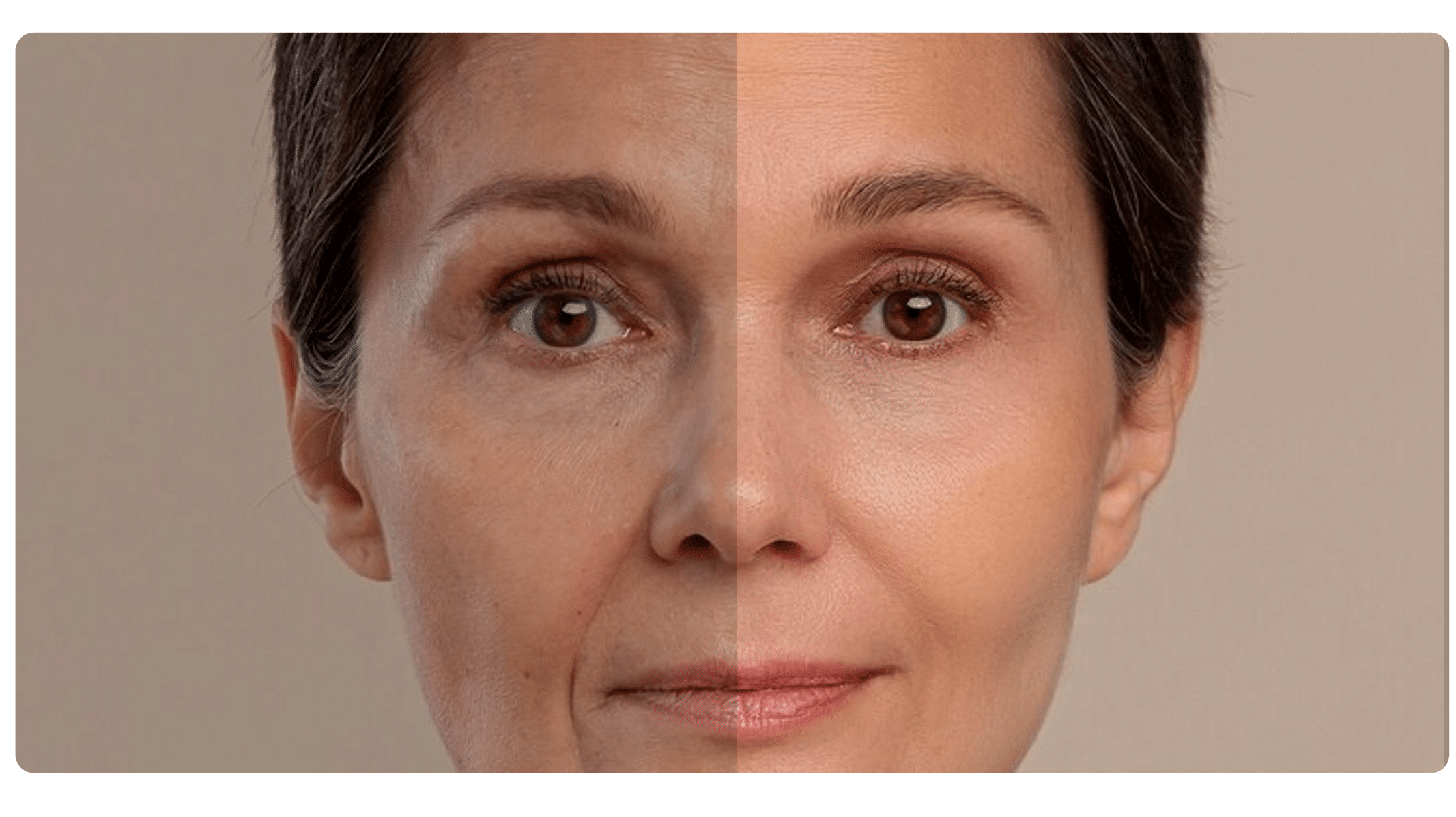 Aprenda a Rejuvenescer seu Rosto em Casa: Botox Caseiro com 4 Igredientes Simples é a Solução!