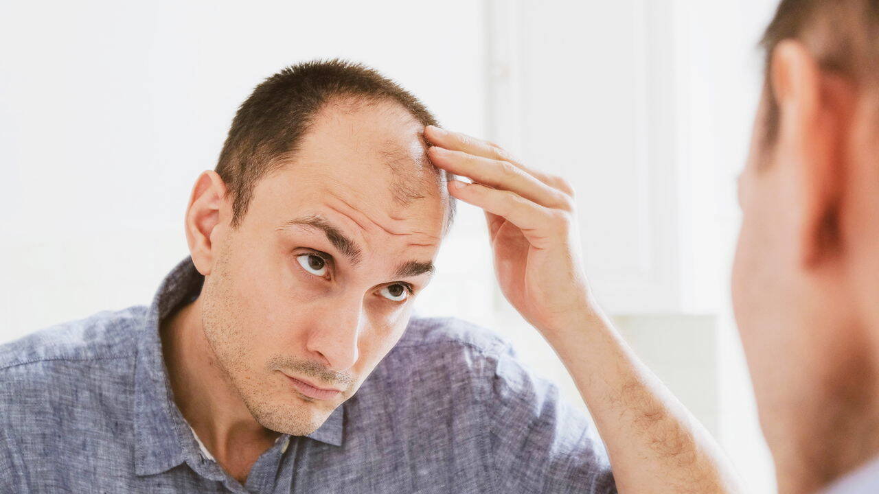 Além da Aparência: A Calvície e o Abismo na Autoestima Masculina