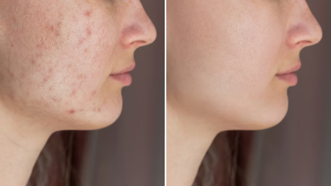Cerave Gel de Limpeza – O Gel de Limpeza Facial com Ácido Salicílico que Está Conquistando a Internet!