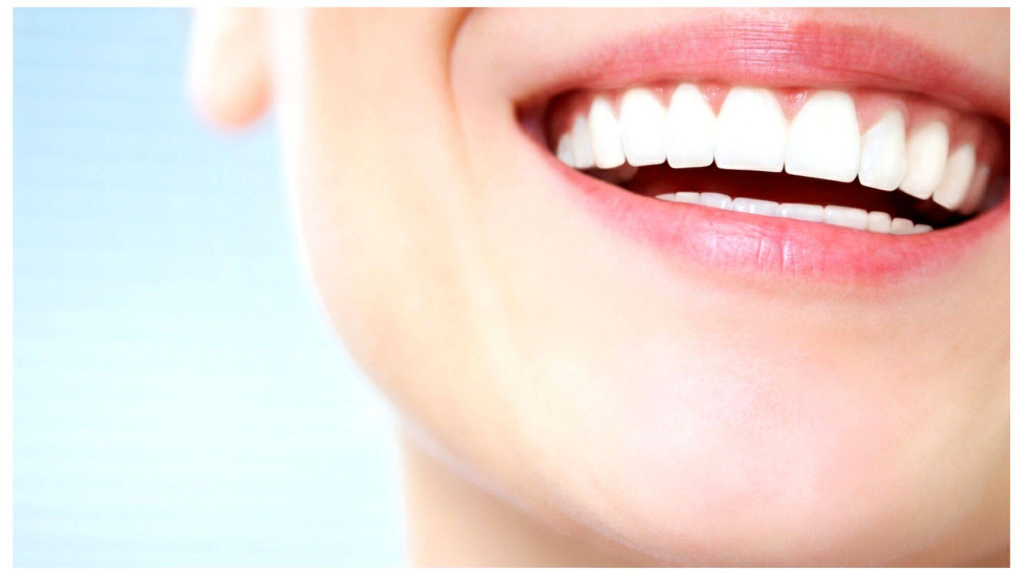 Surpreenda-se! O Segredo das Lentes de Contato Dental Que Todos Querem Saber!